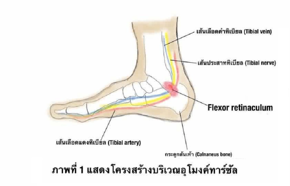 ภาพที่ 1 แสดงโครงสร้างบริเวณอุโมงค์ทาร์ซัล